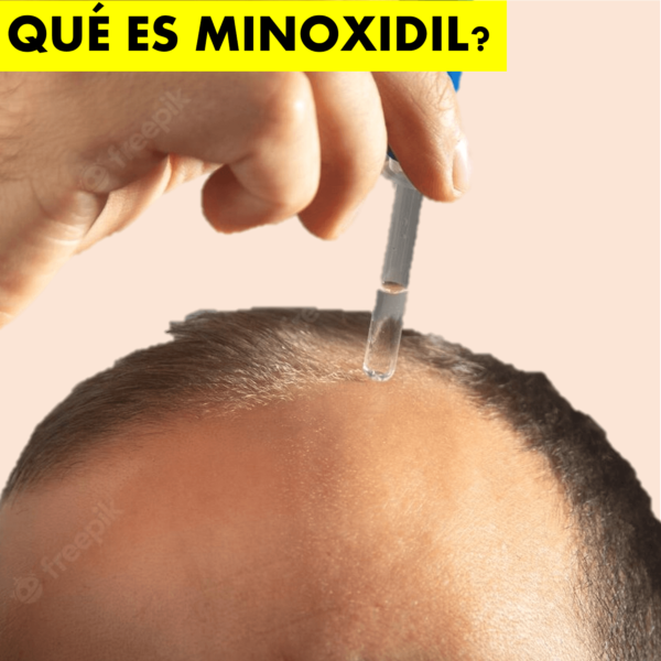 Minoxidil Kirkland Desde Minoxidil Df Ventas