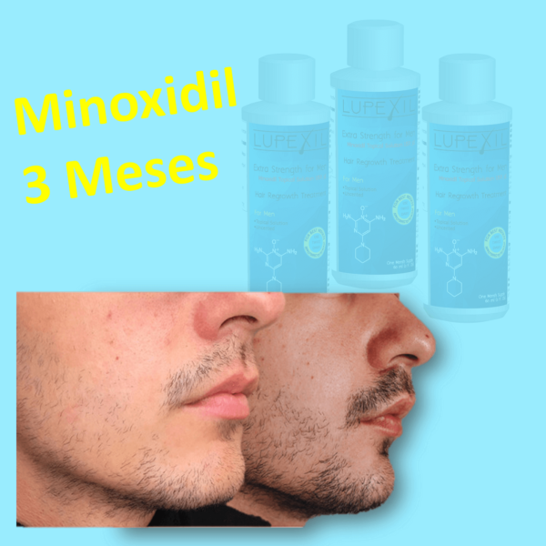 minoxidil 3 meses precio resultados