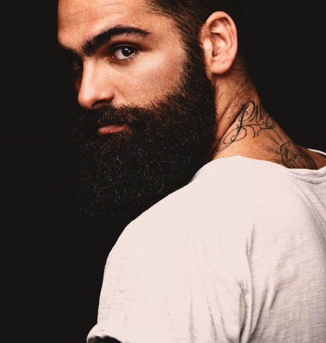 precio del minoxidil precio del minoxidil