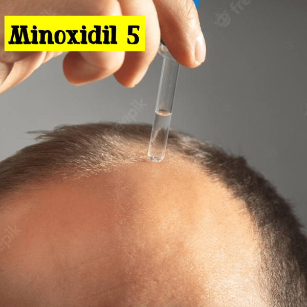 minoxidil 5