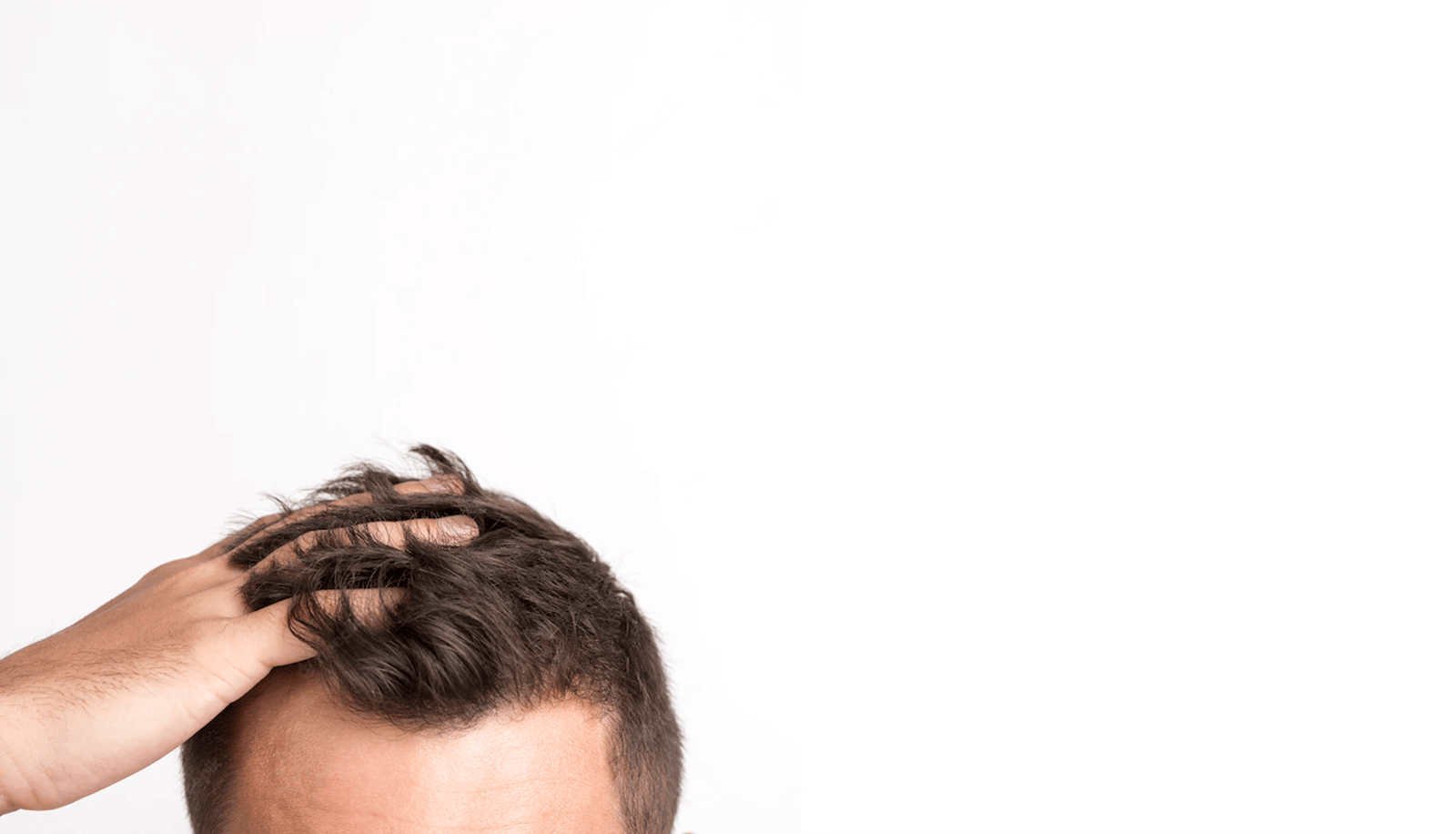 minoxidil cabello precio mexico