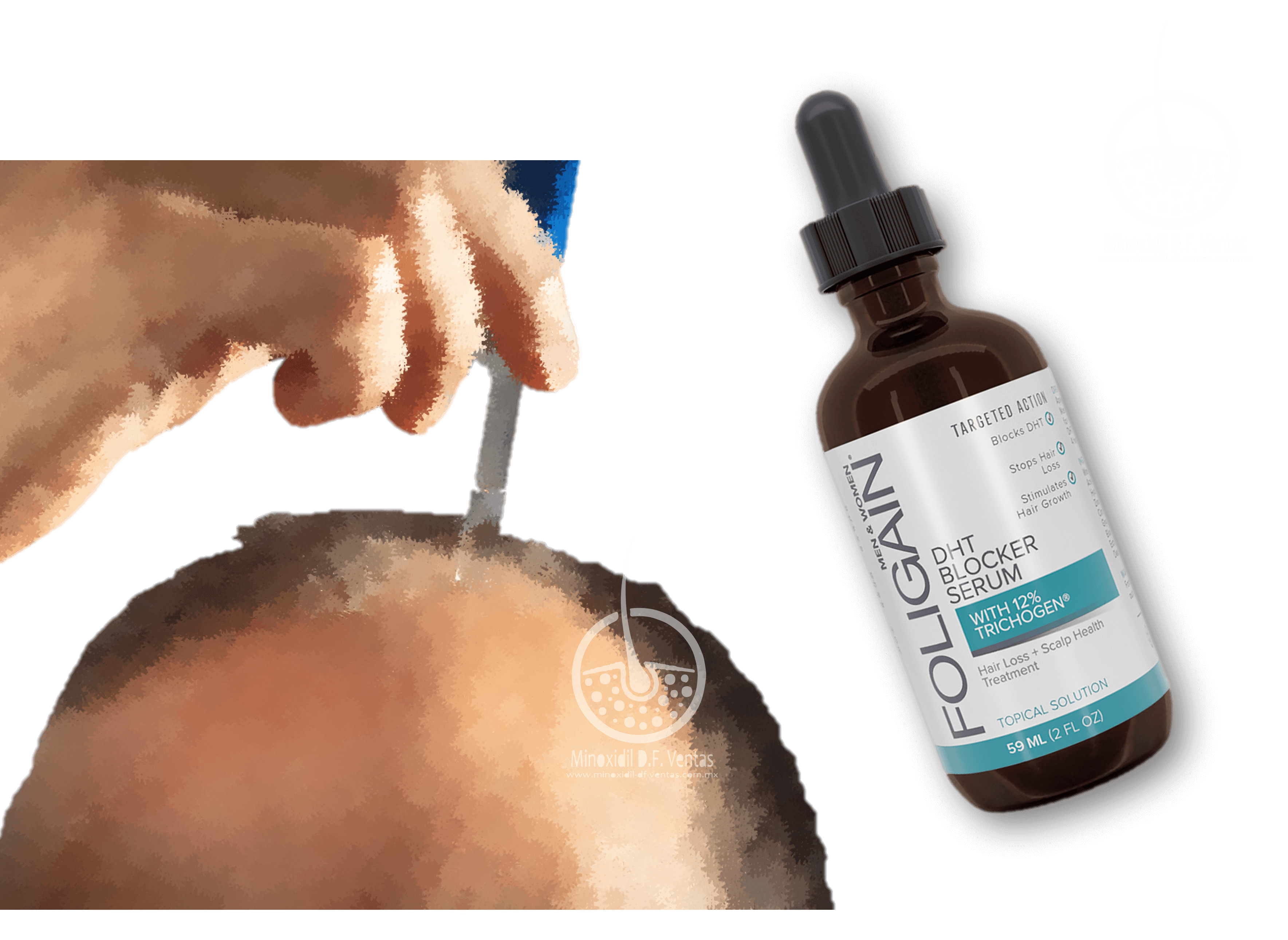 minoxidil cabello mexico minoxidil cabello mexico